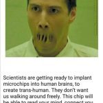 Brain Chip Implants Begin
